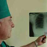 Новгородские медики с начала года выявили около ста новых больных туберкулезом