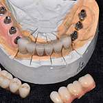 В Новгородской области стоматологи и их клиент получили своё благодаря суду