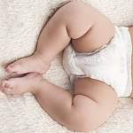 Вредят ли здоровью малышей подгузники и насколько опасен крипторхизм?