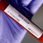 У врача Гатчинской клинической больницы выявили коронавирус