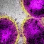 Способен ли алгоритм предсказать развитие пандемии коронавируса?